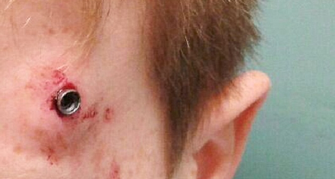 Inghilterra: giovane calciatore ferito da proiettile in campo