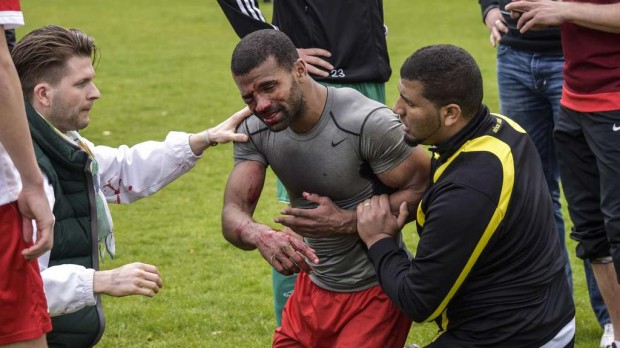 Berlino, mega rissa a fine partita: calciatore rischia un occhio