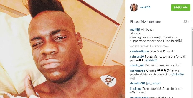 Mario Balotelli operato: torna tra 4 setimane