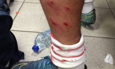 Matos-Carpi